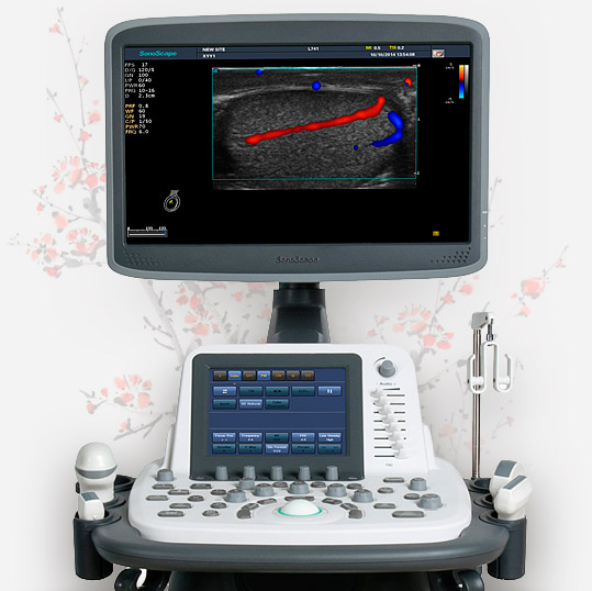 Ультразвуковой сканер S20Exp от SonoScape - Фото 2